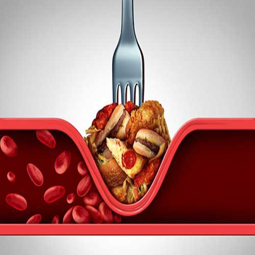 ارتباط میزان مصرف کربوهیدرات با مرگ و میر مبتلایان به تصلب شرائین